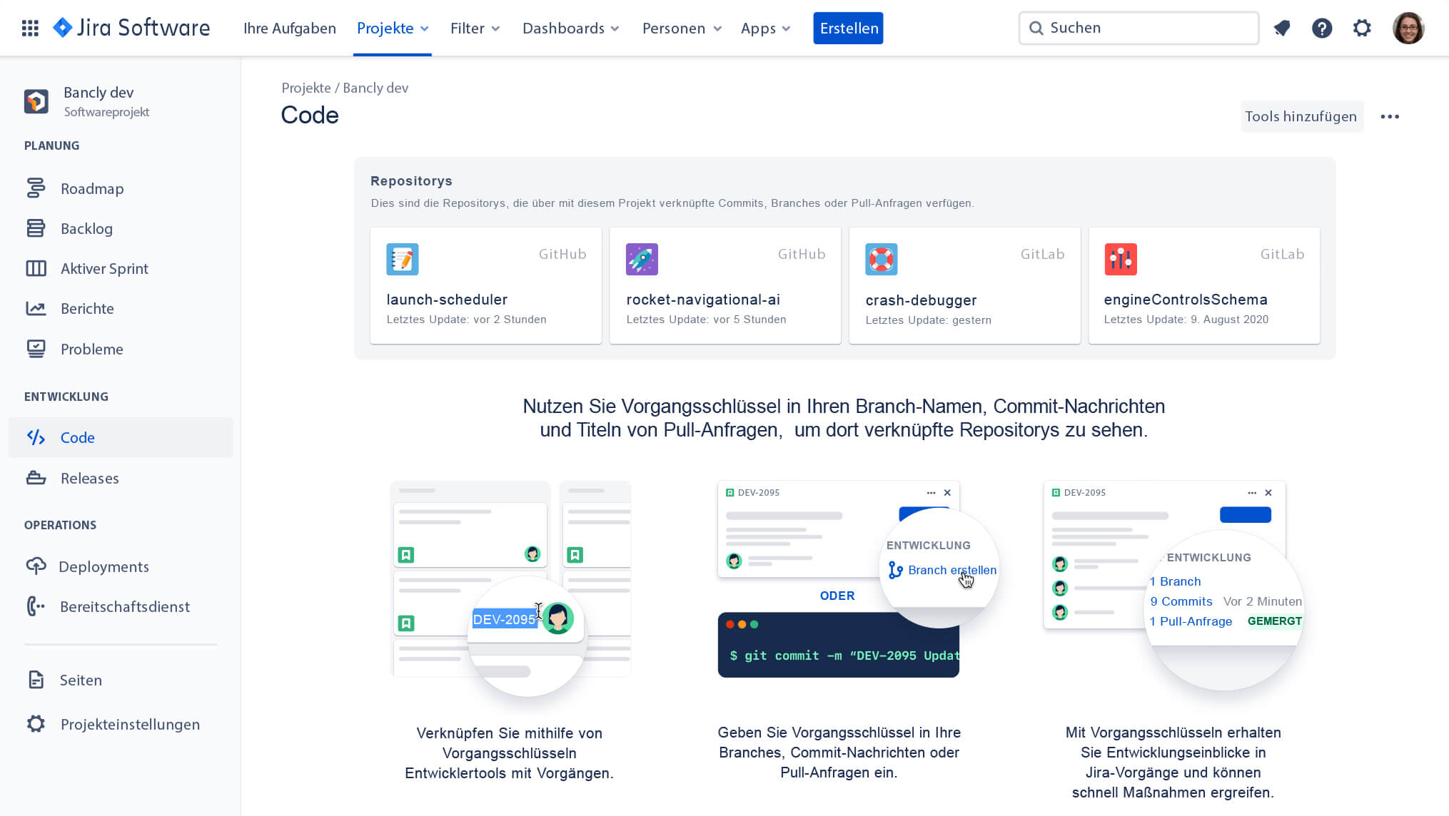 Code in Jira